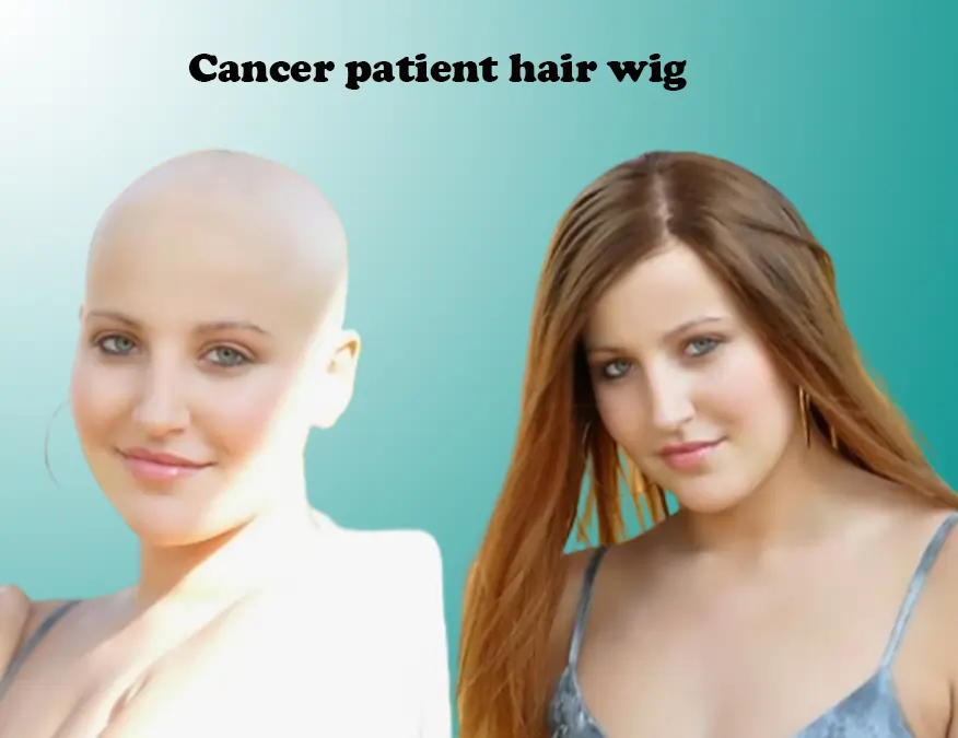 Hair wig for outlet cancer patient